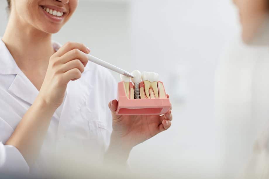 woman making a demonstration with a dental implant model