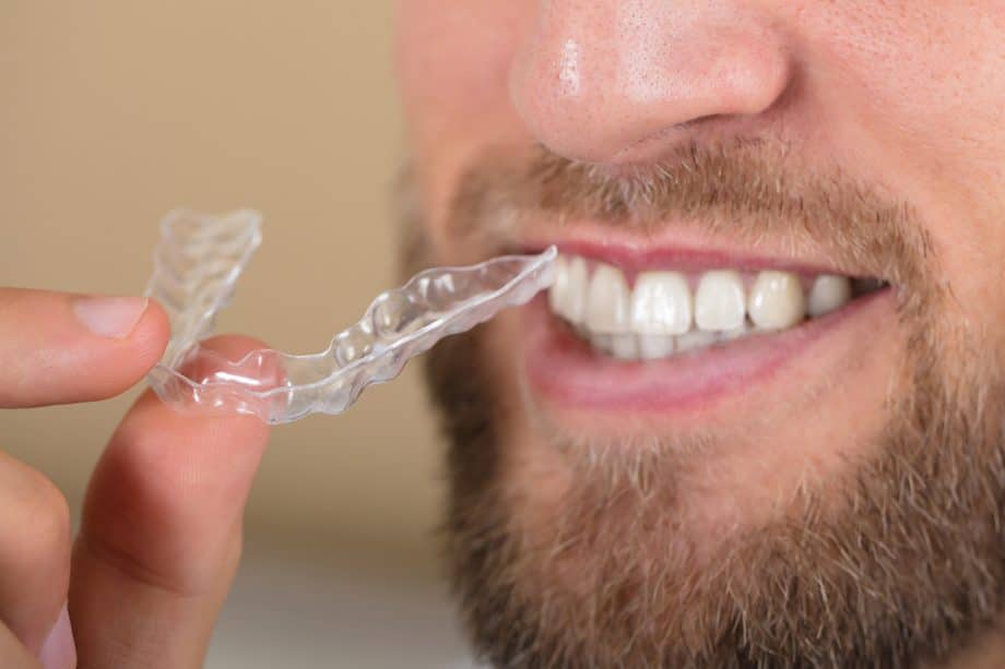 bearded man holding an Invisalign aligner tray close to his mouth