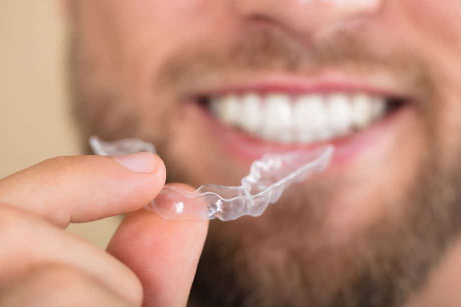 What is Invisalign & How Does it Work?